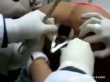 Dildo Recovered From Ass In Hospital - Dildo Videos