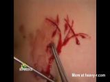 Extreme Tit torture - Tit torture Videos