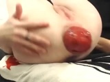 Prolapsed Anus After Vacuum Pumping - Anal Videos